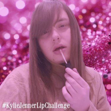 ALBUM: ox33n – Kylie Jenner Lip Challenge (Zip Download)